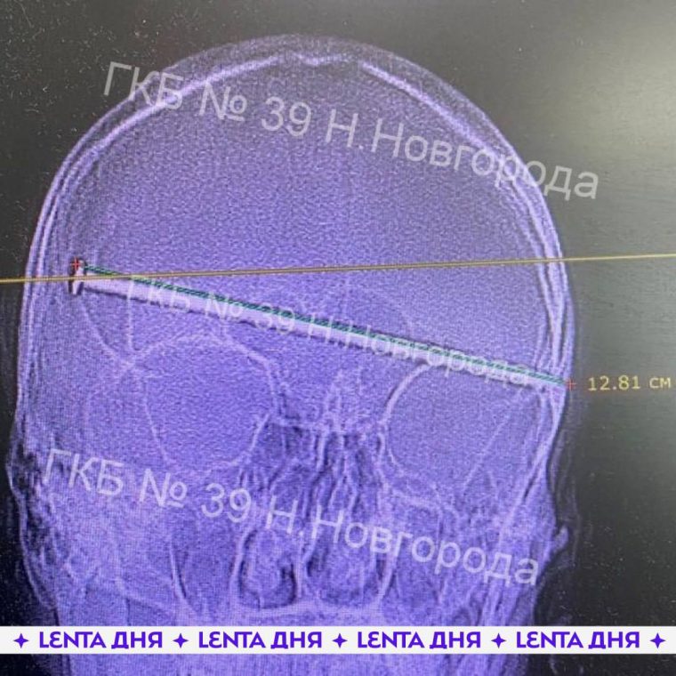 post-28889 thumbnail