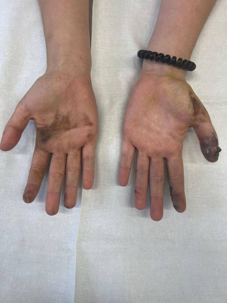 post-29535 thumbnail